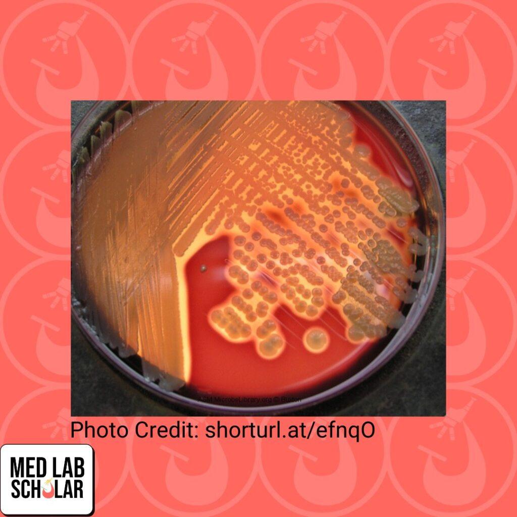 Swab sample of a wound had growth on a BA plate.